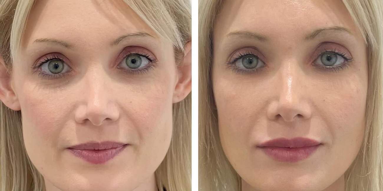 Arnicare Stockists - Evolve Skin Aesthetics