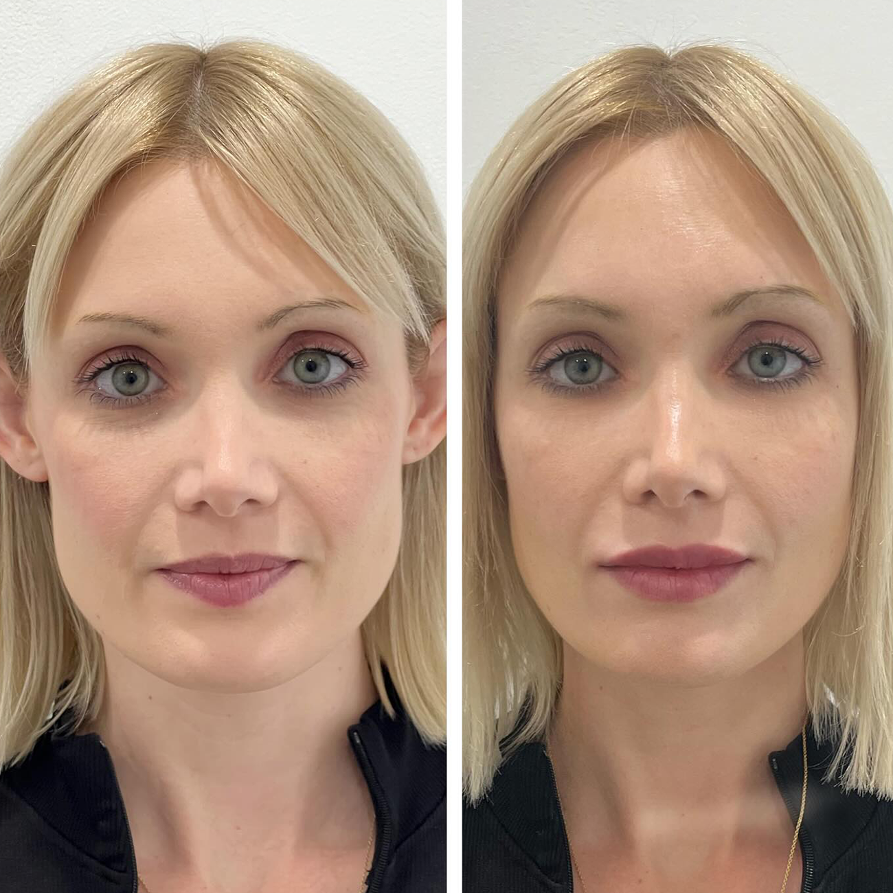 Arnicare Stockists - Evolve Skin Aesthetics